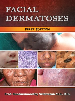 cover image of Facial Dermatoses